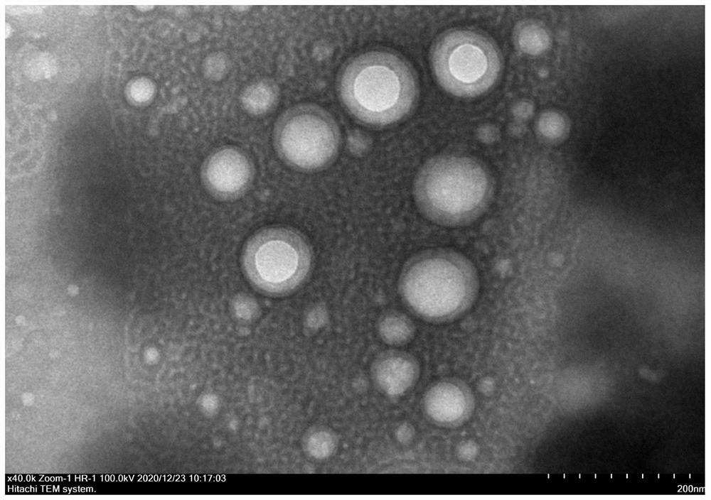 PD-L1 targeted sorafenib-loaded PLGA nano preparation and preparation method thereof