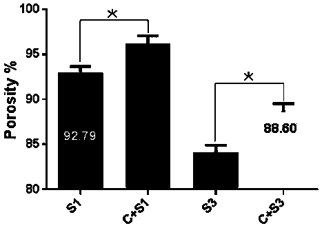 Bone repairing biological material prepared by using abalone shell, and preparation method thereof