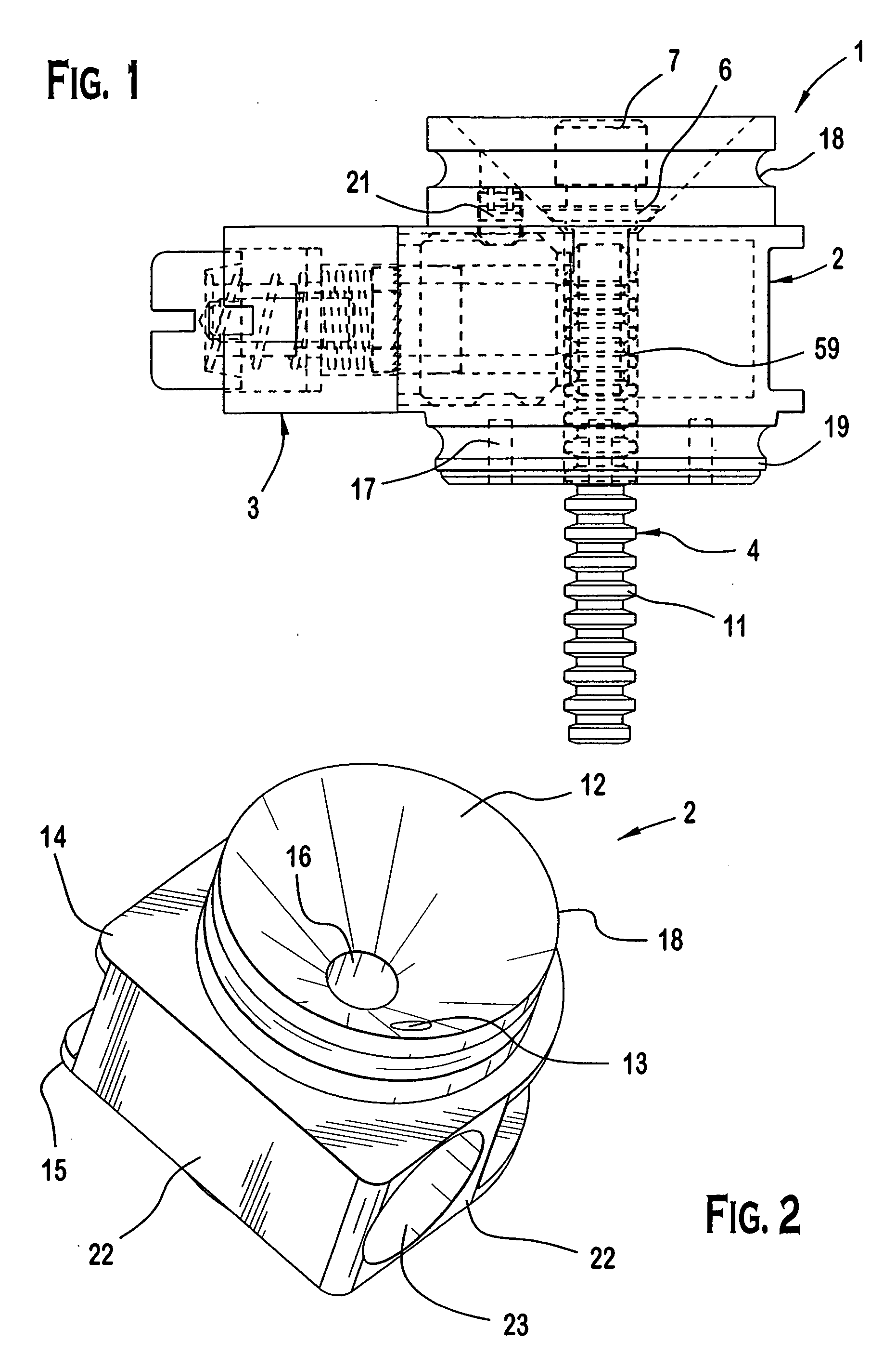 Prosthetic attachment locking device with dual locking mechanism