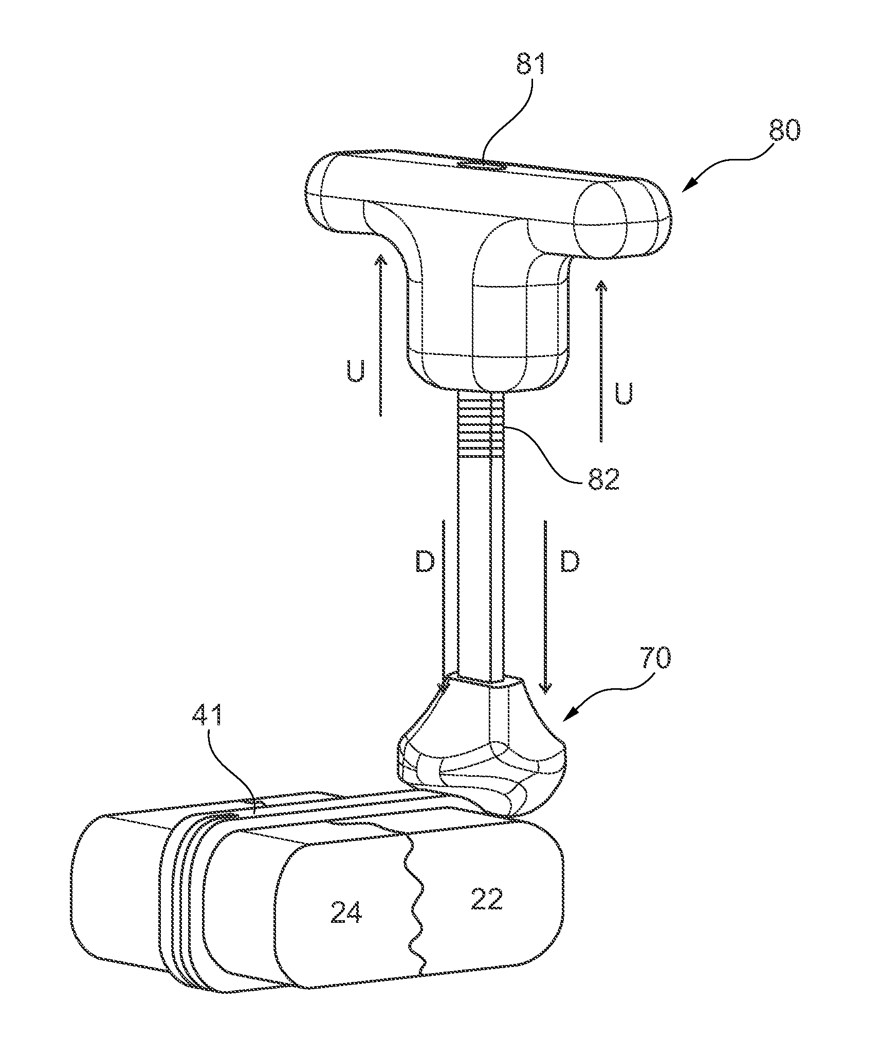 Apparatus and methods for securing together bone fragments