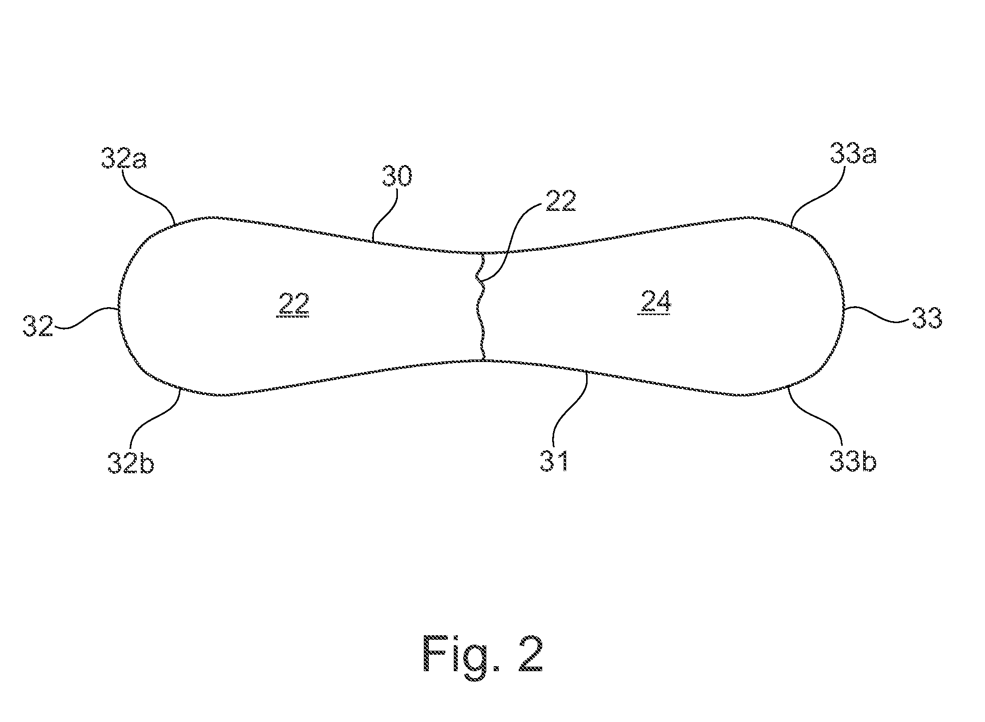 Apparatus and methods for securing together bone fragments