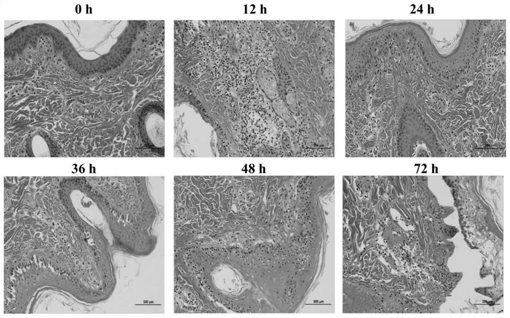 Dairy cow interdigital skin explant model construction method