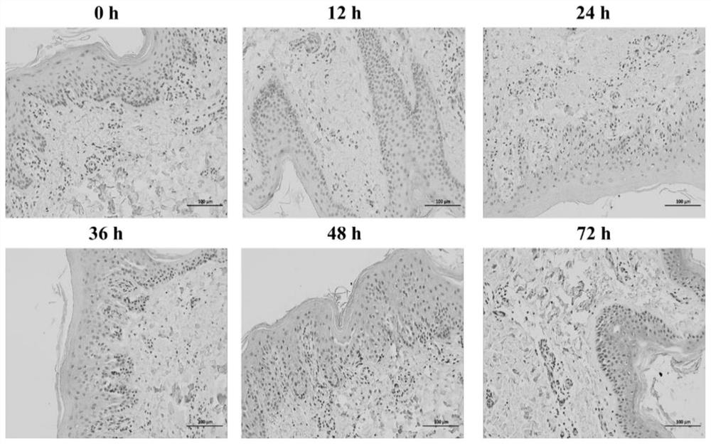 Dairy cow interdigital skin explant model construction method