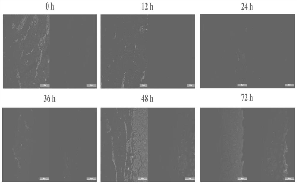 Dairy cow interdigital skin explant model construction method