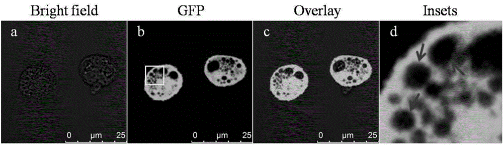 Method for observing morphology and functions of lysosomes by using transgenic macrophage expressing GFP or mutants thereof