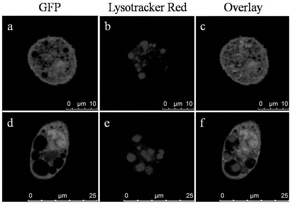 Method for observing morphology and functions of lysosomes by using transgenic macrophage expressing GFP or mutants thereof