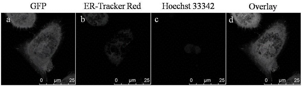 Method for observing morphology and functions of lysosomes by using transgenic macrophage expressing GFP or mutants thereof