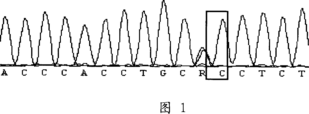 Discrimination of MUC4 mononucleotide polymorphic site with obvious effect on diarrhea resistance of weaned piglet and its application