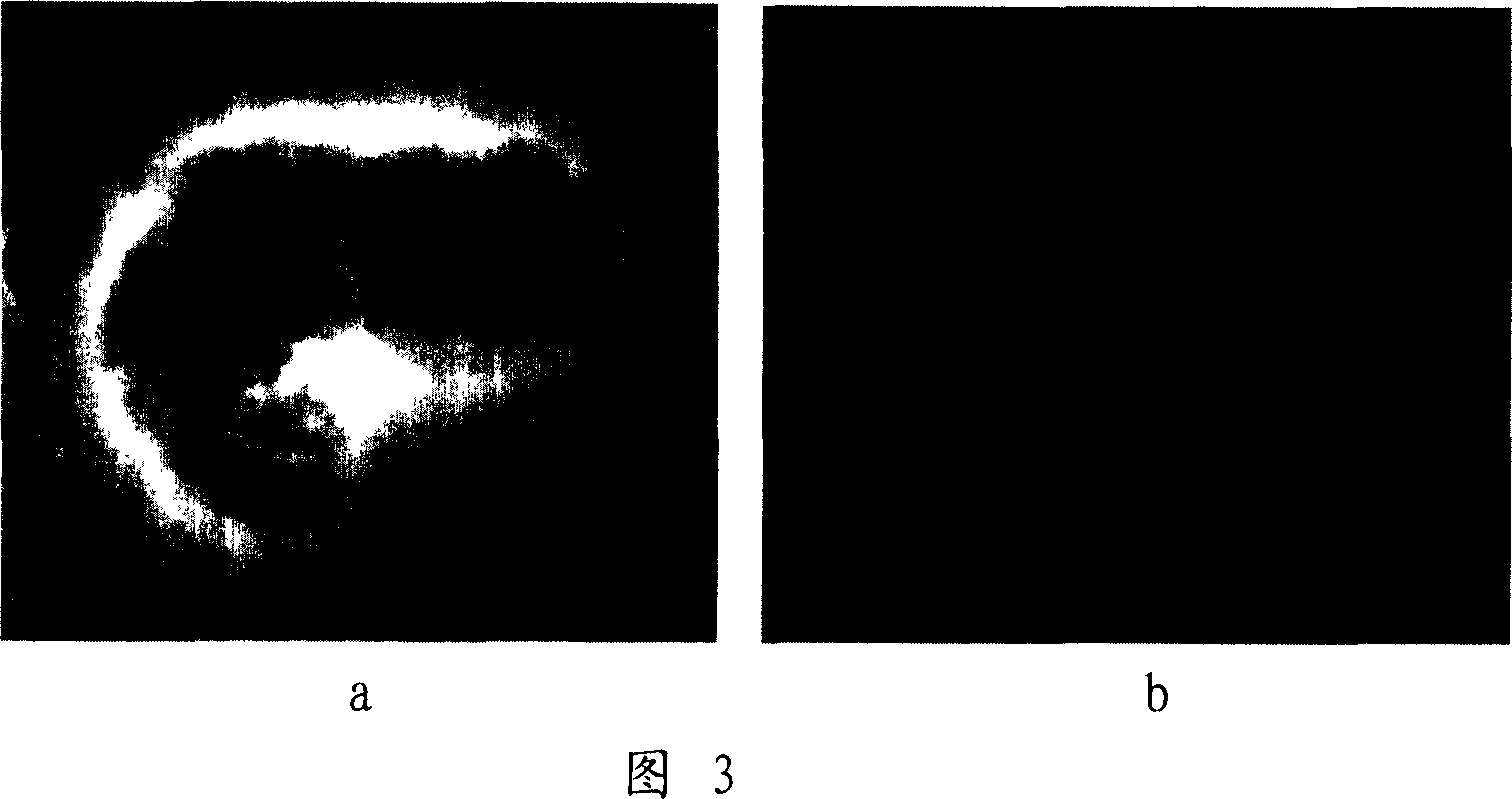 Discrimination of MUC4 mononucleotide polymorphic site with obvious effect on diarrhea resistance of weaned piglet and its application