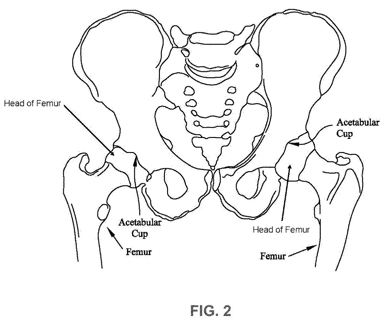 Systems and methods for pre-operative visualization of a joint