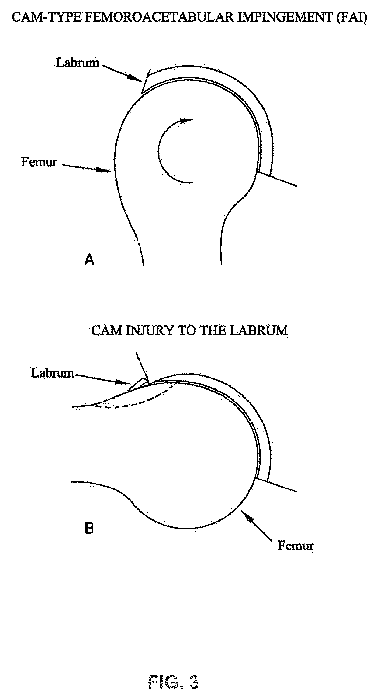 Systems and methods for pre-operative visualization of a joint