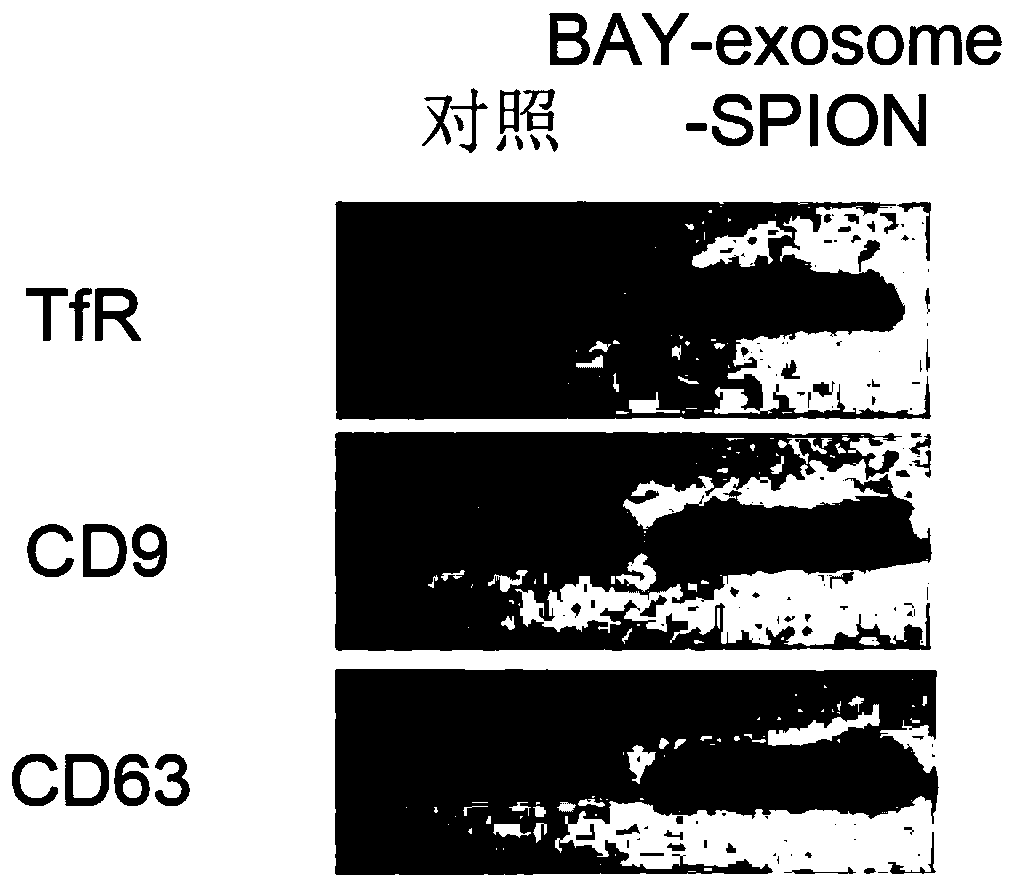 Superparamagnetic nano-iron modified exosome drug-loading nano-system, preparation method and blood glucose response method thereof