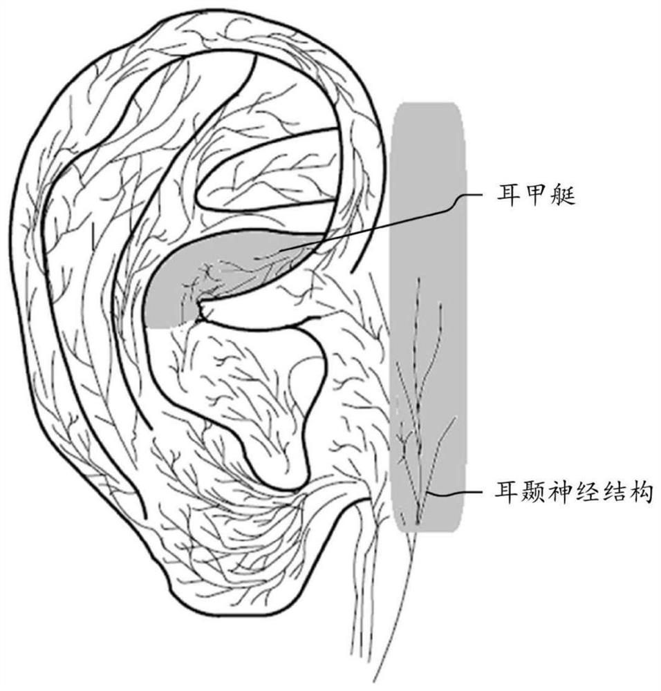 Systems and methods for delivery of therapy using ear stimulation device