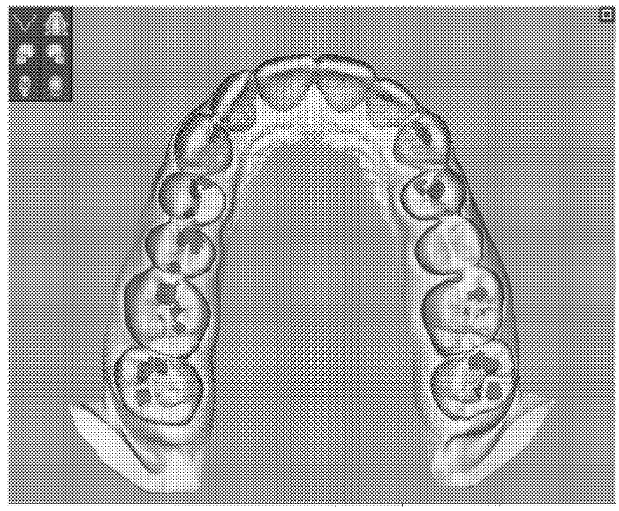 Method for determining a mapping of the contacts and/or distances between the maxillary and mandibular arches of a patient