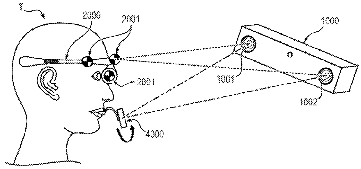 Method for determining a mapping of the contacts and/or distances between the maxillary and mandibular arches of a patient