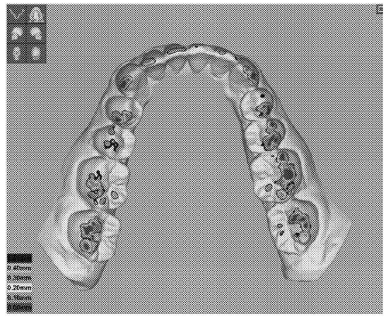 Method for determining a mapping of the contacts and/or distances between the maxillary and mandibular arches of a patient