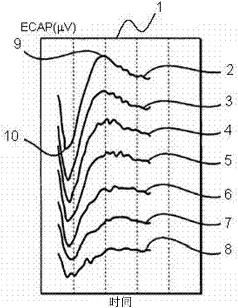 Method and system for rapid acquisition of evoked compound action potential recordings