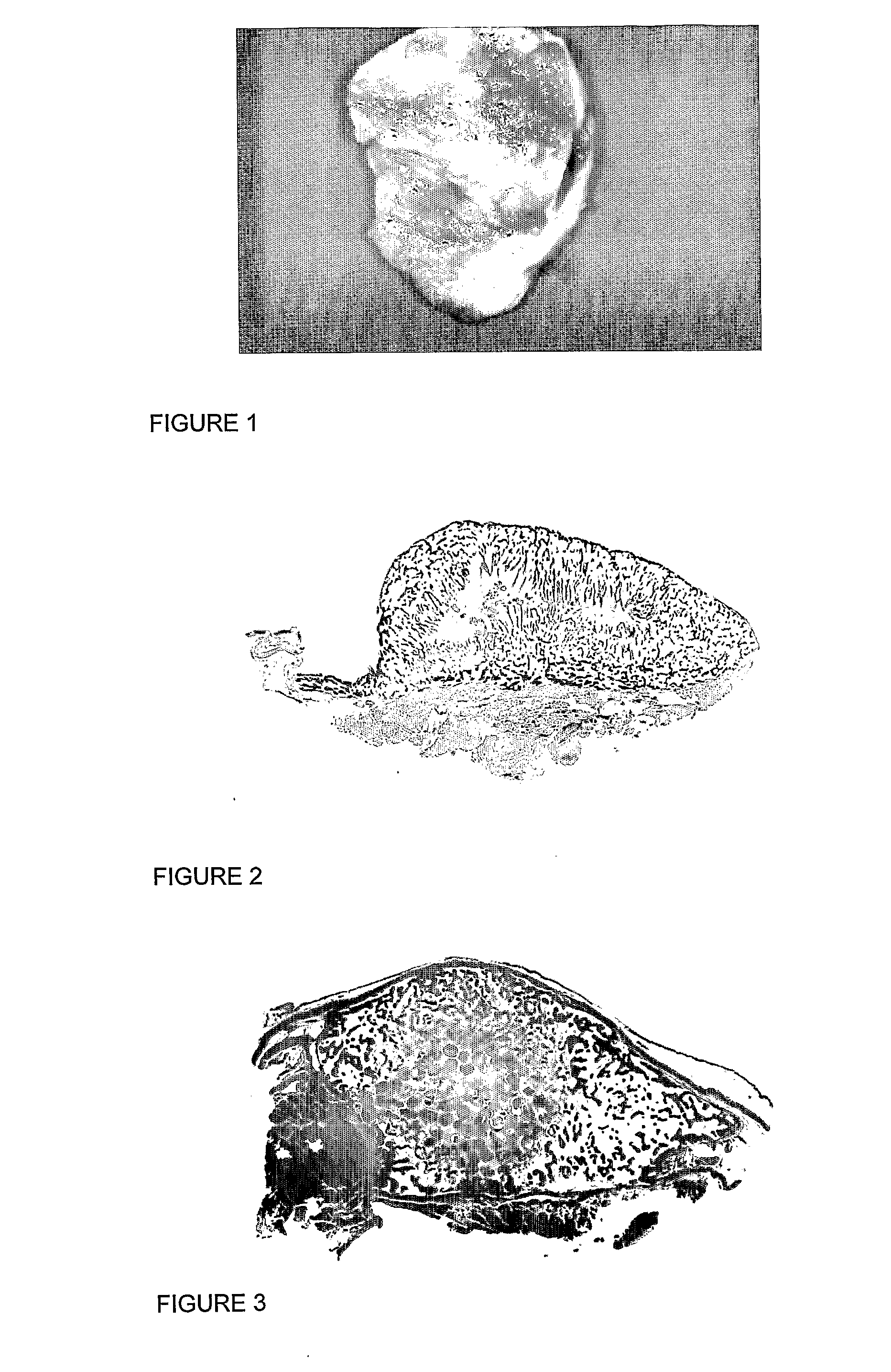 Osteogenic Device for Inducing Bone Formation in Clinical Contexts