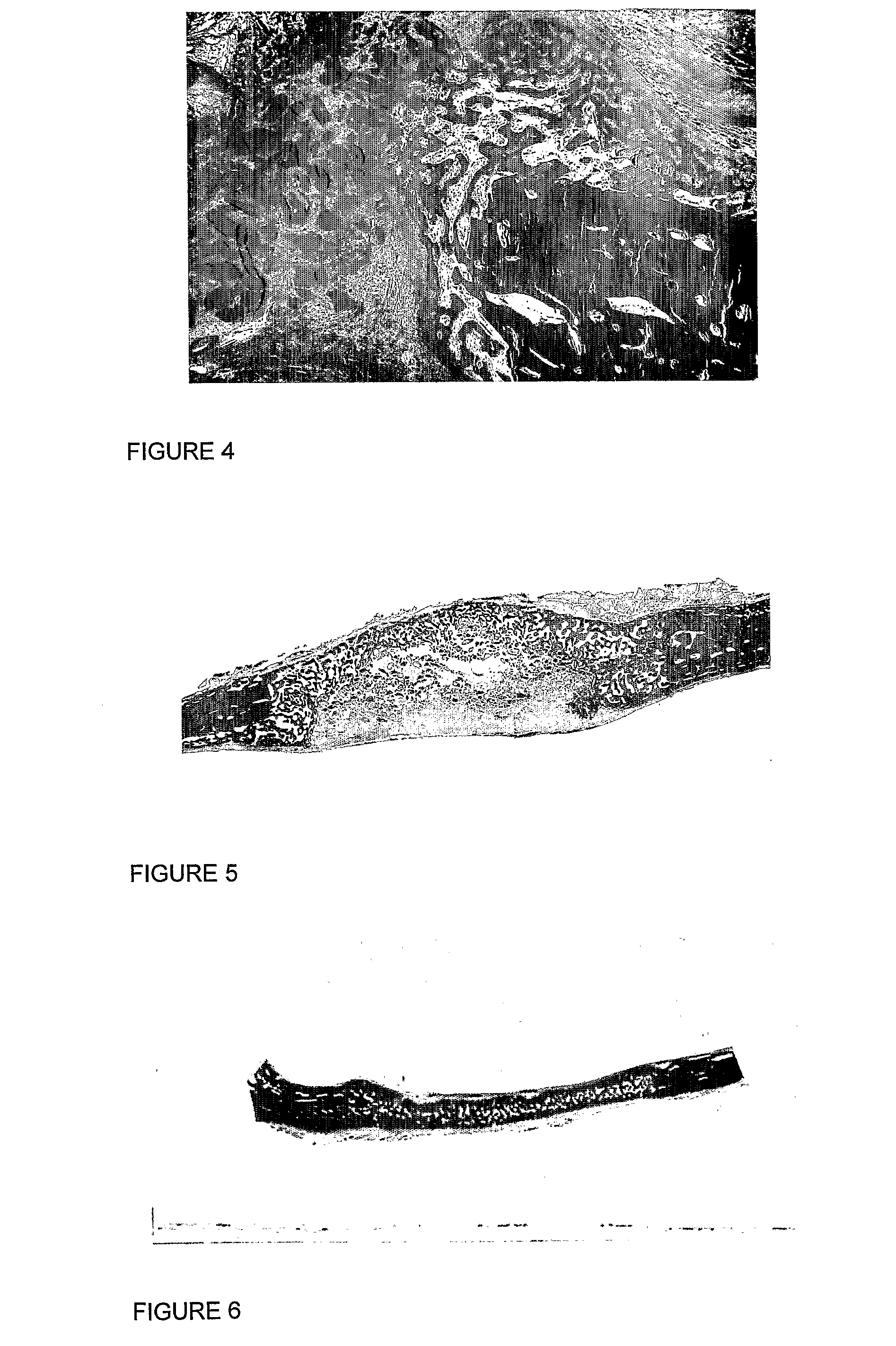 Osteogenic Device for Inducing Bone Formation in Clinical Contexts