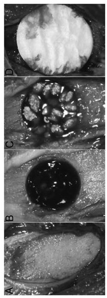 CHA gelatin stent