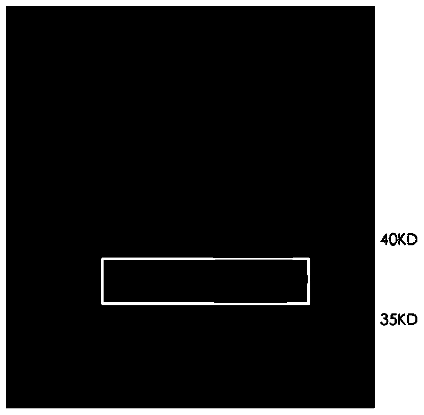 Anti-human GPC3 monoclonal antibody