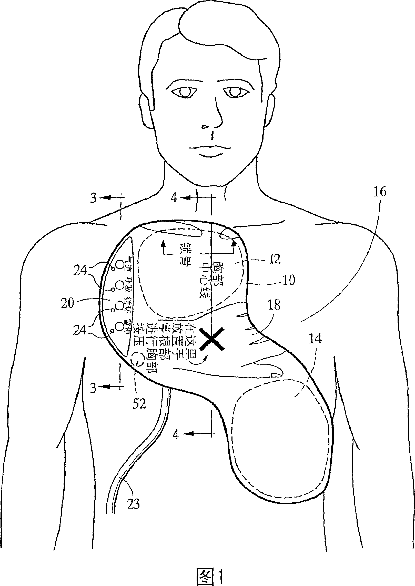 Integrated resuscitation