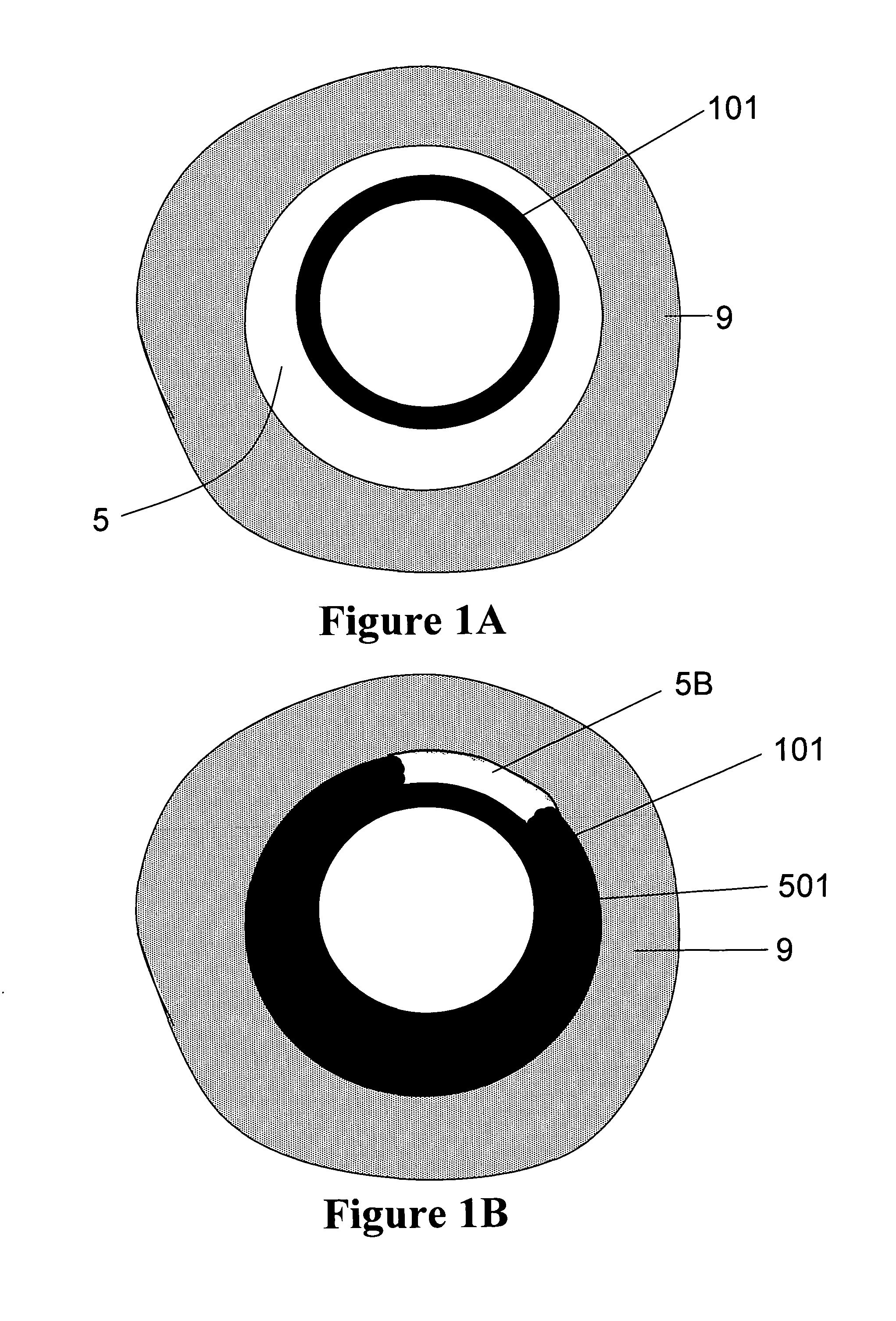 Method and composition for zonal isolation of a well