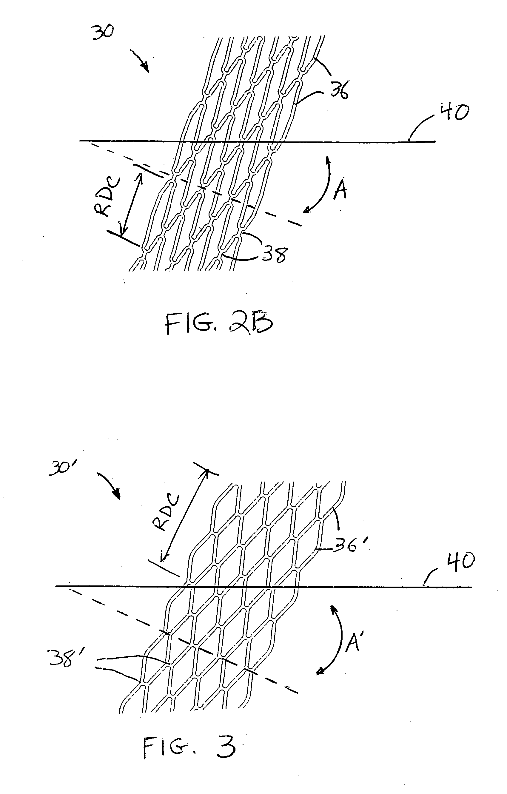 Vascular prothesis having flexible configuration