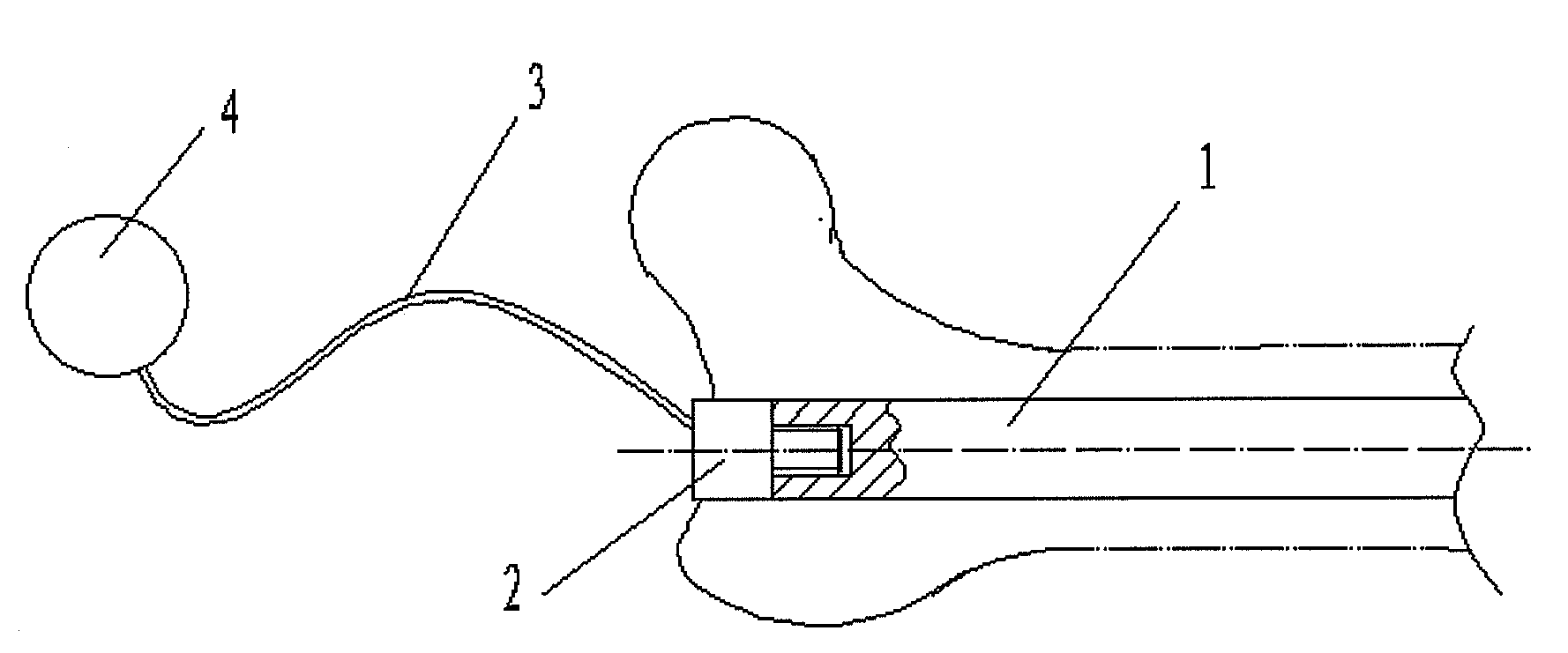 Intramedullary nail, method for embedding and extracting the same