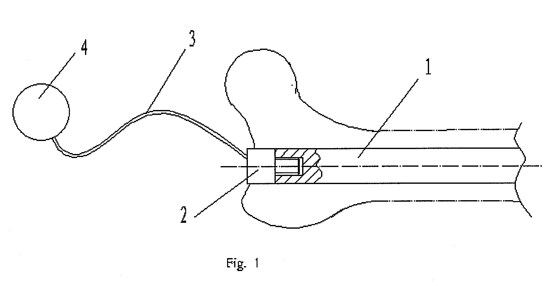 Intramedullary nail, method for embedding and extracting the same