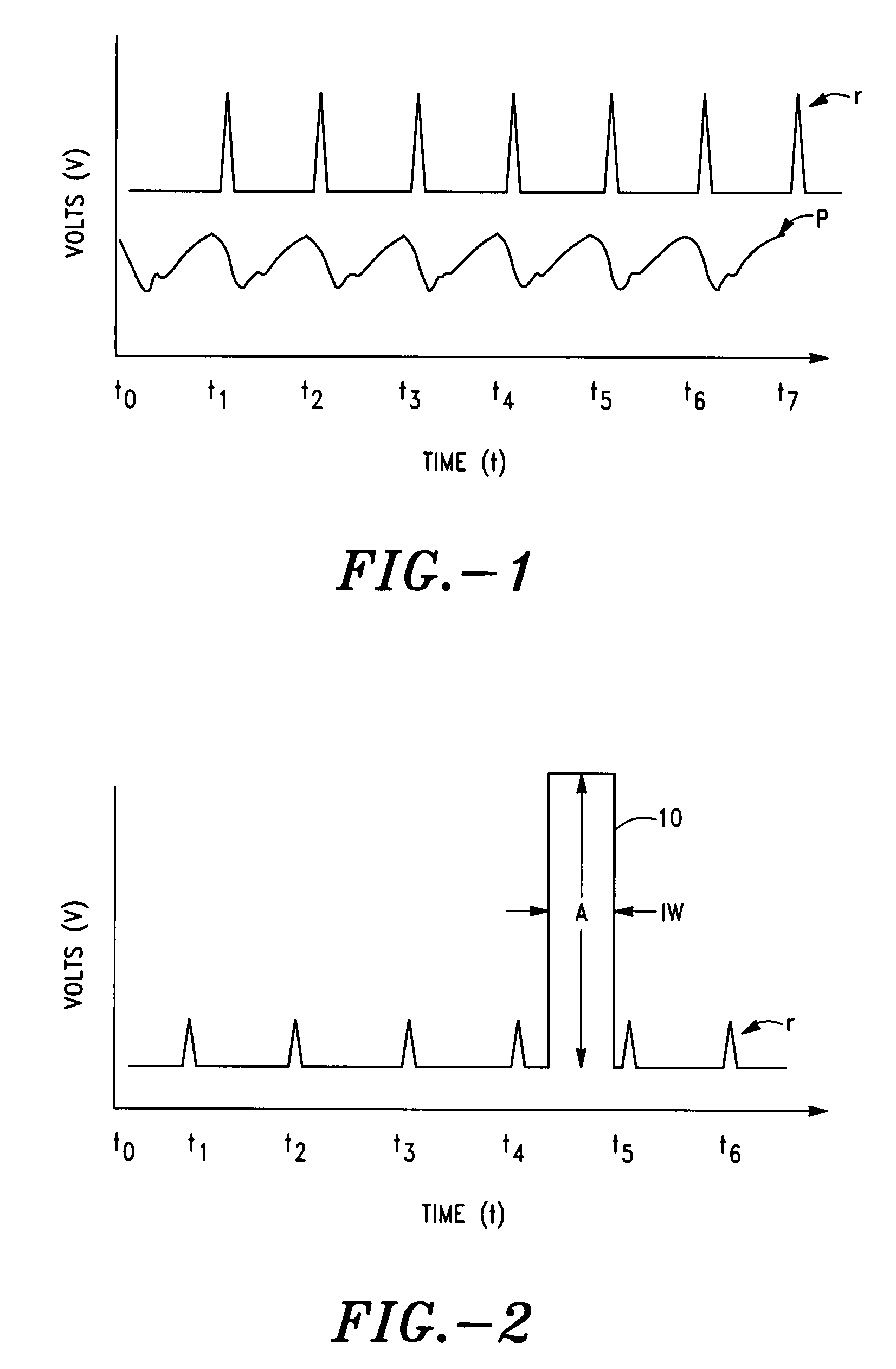 Method and system for controlling amplified signals reflecting physiological characteristics