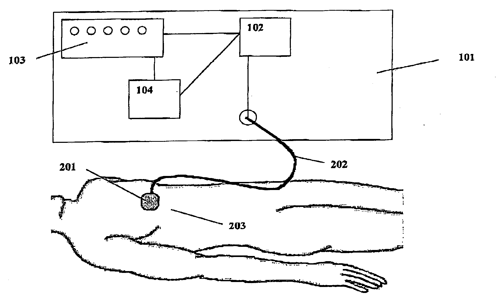 Method and device for adipose tissue treatment