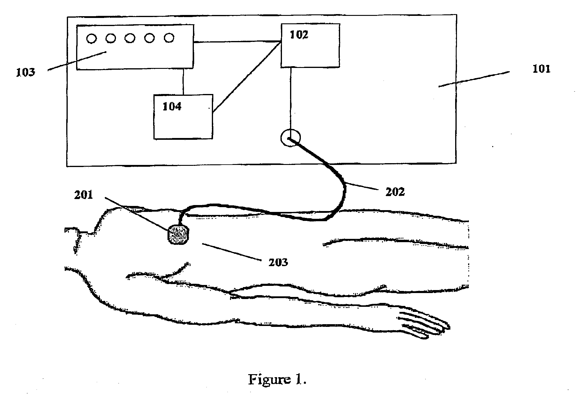 Method and device for adipose tissue treatment