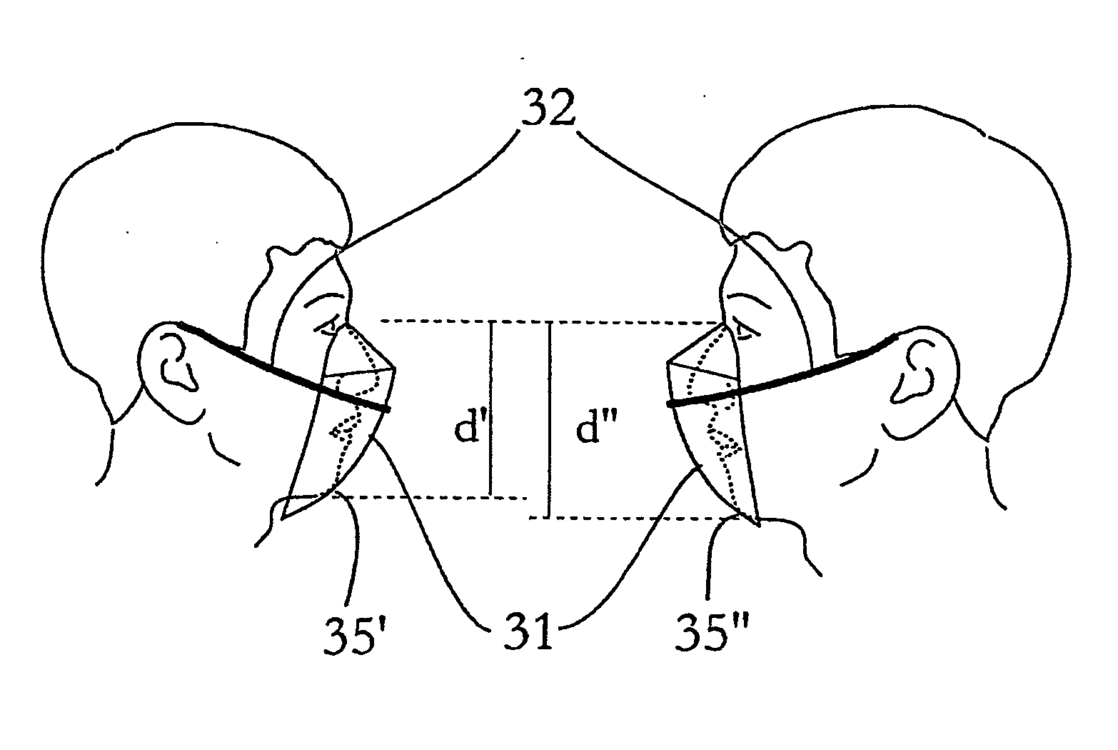 Flat-foldable face-mask and process of making same