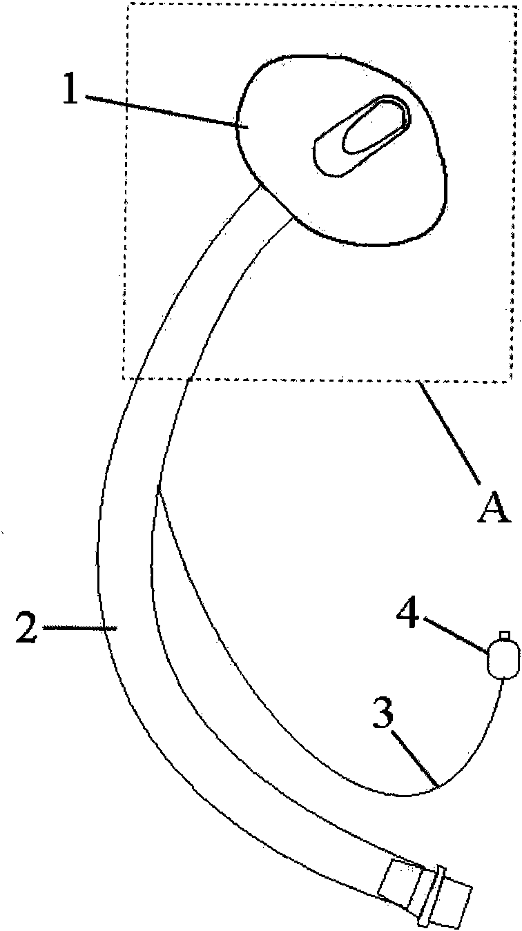 Transnasal laryngeal mask