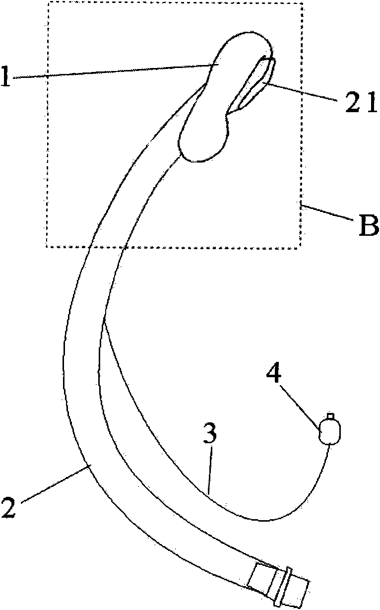 Transnasal laryngeal mask