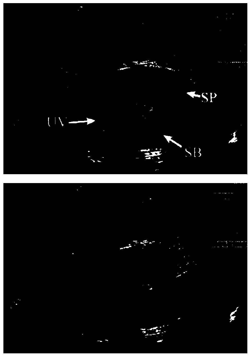 Ultrasonic image video classification prediction method and system