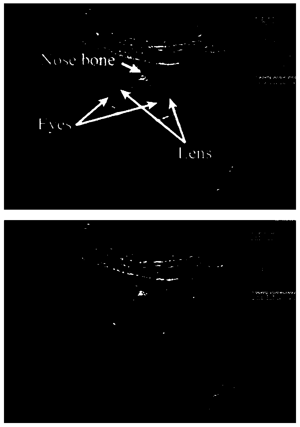 Ultrasonic image video classification prediction method and system