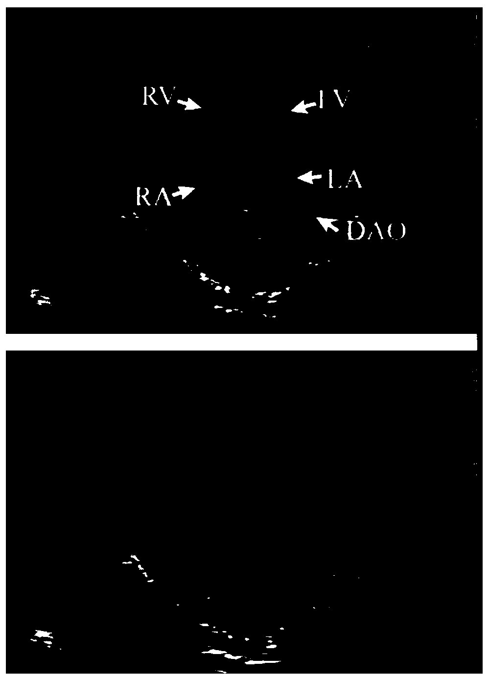 Ultrasonic image video classification prediction method and system