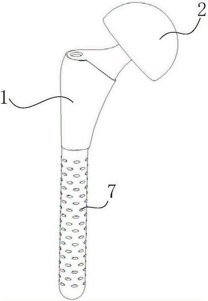 Prosthesis component for drug-release treatment of postoperative infection of joints