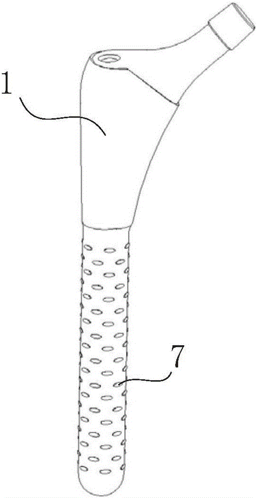 Prosthesis component for drug-release treatment of postoperative infection of joints