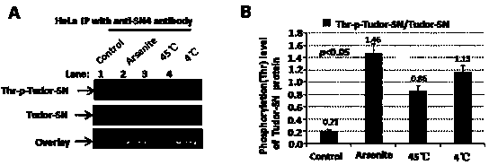 Preparation method of stress phosphorylation antibody aiming at human Tudor-SN protein T103 site