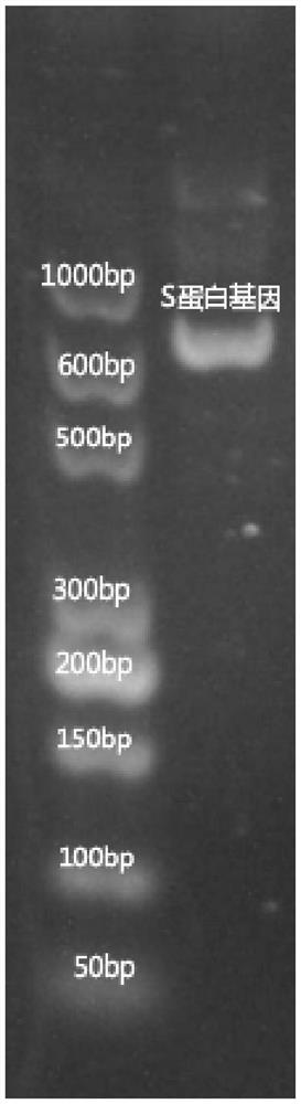 2019-nCoV double-target antibody detection microsphere complex combination, preparation method, kit and use method of kit