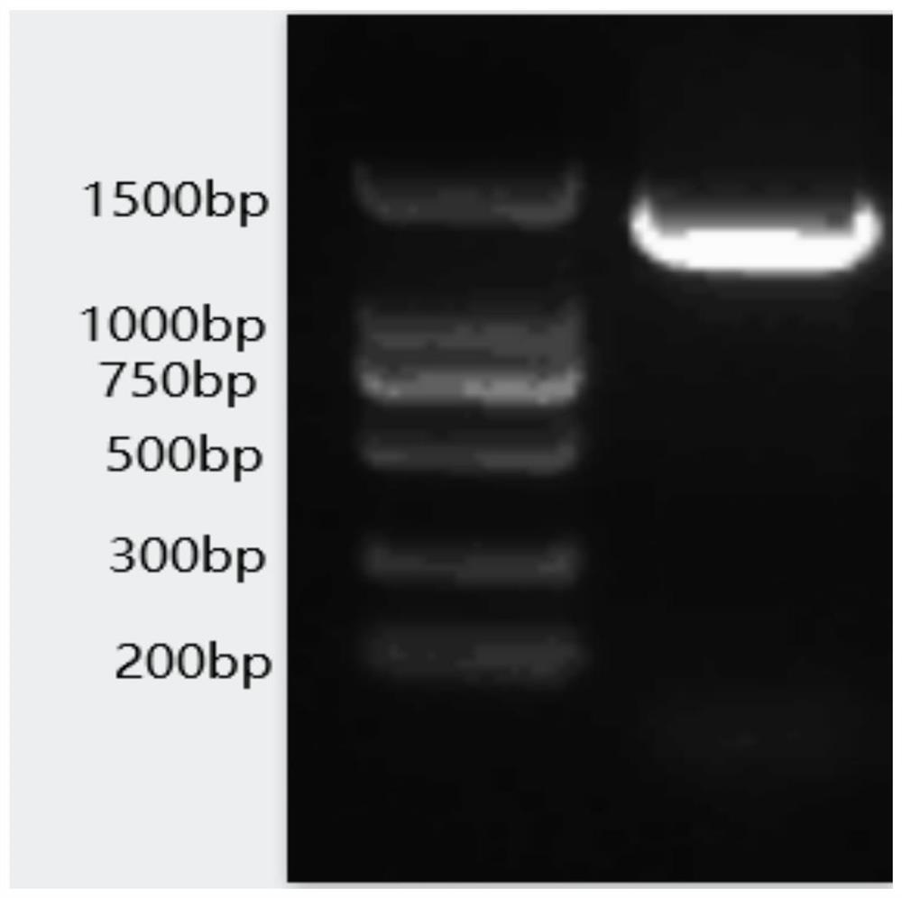 2019-nCoV double-target antibody detection microsphere complex combination, preparation method, kit and use method of kit