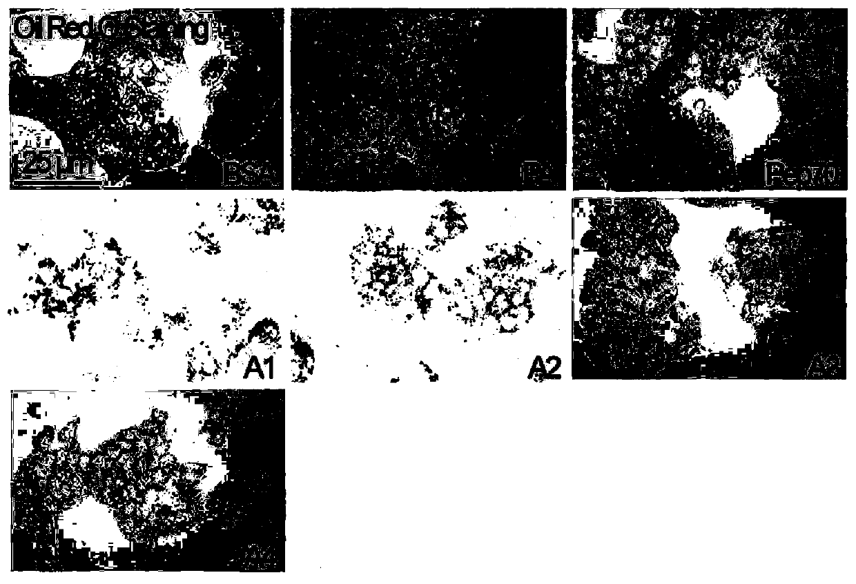 Dual agonist peptide of adiponectin receptor-1 and receptor-2 for treating NAFLD and liver fibrosis