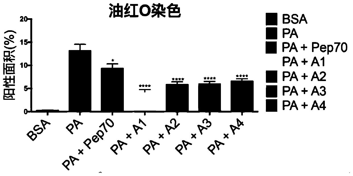 Dual agonist peptide of adiponectin receptor-1 and receptor-2 for treating NAFLD and liver fibrosis