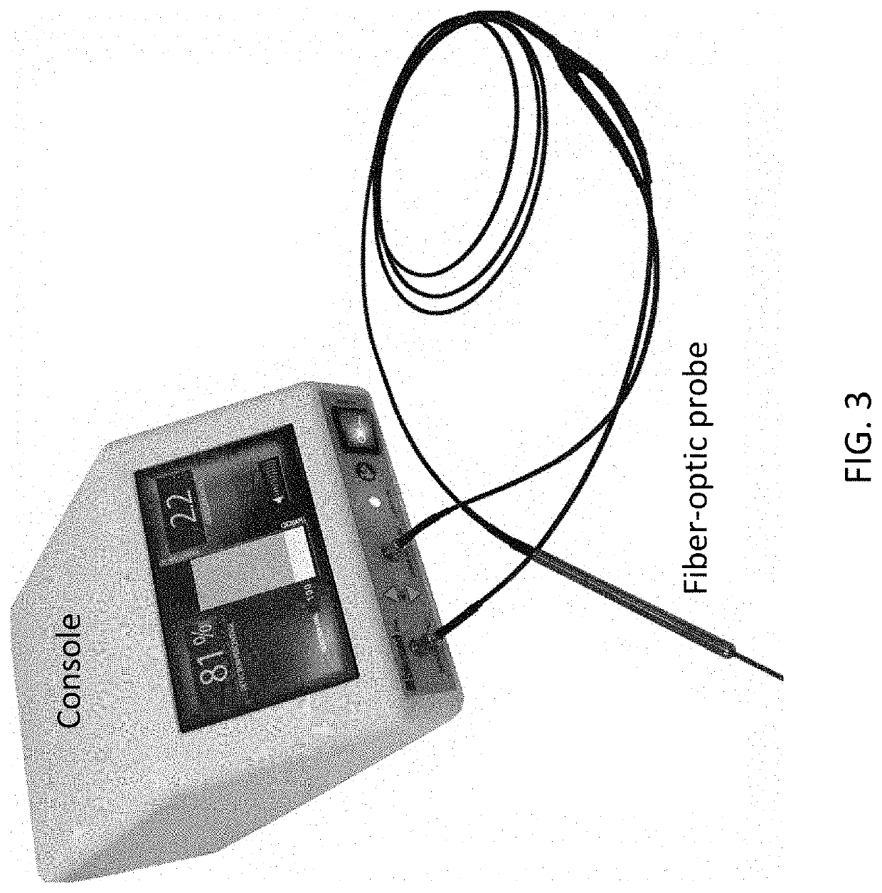 System and method for surgery guidance