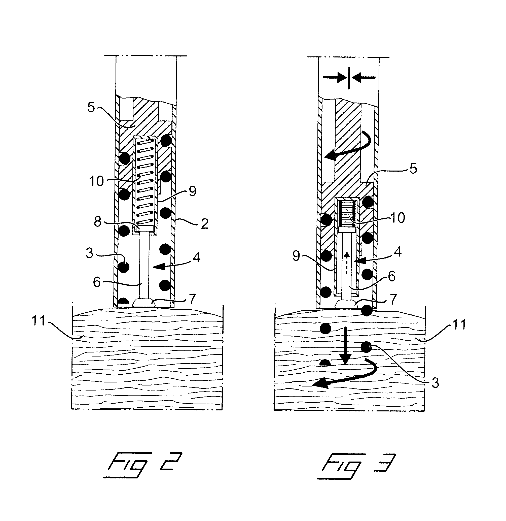 Medical implantable lead and method for connecting a medical implantable lead to an organ