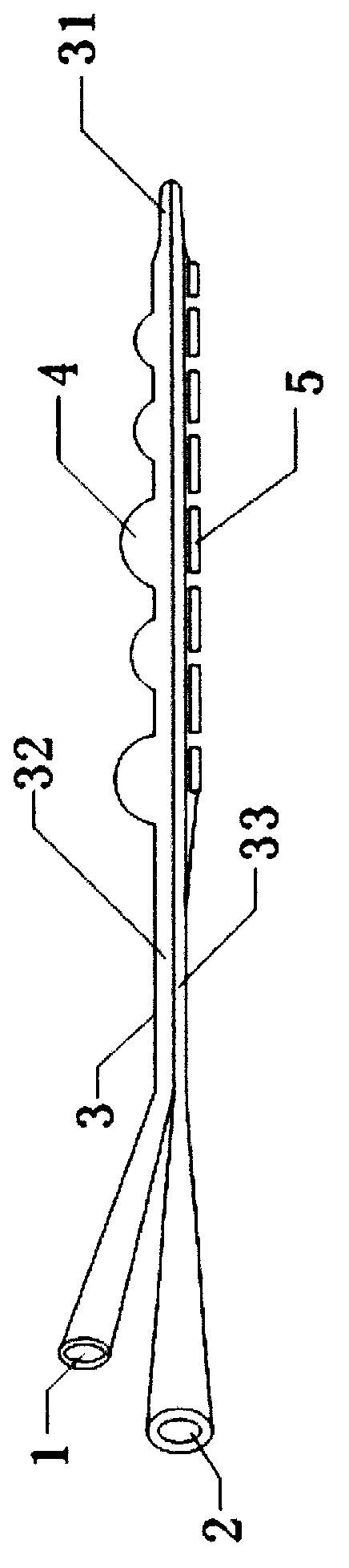 Iliofemoral deep venous thrombosis moniliform eccentric sacculus thrombolysis thrombectomy catheter and using method of same