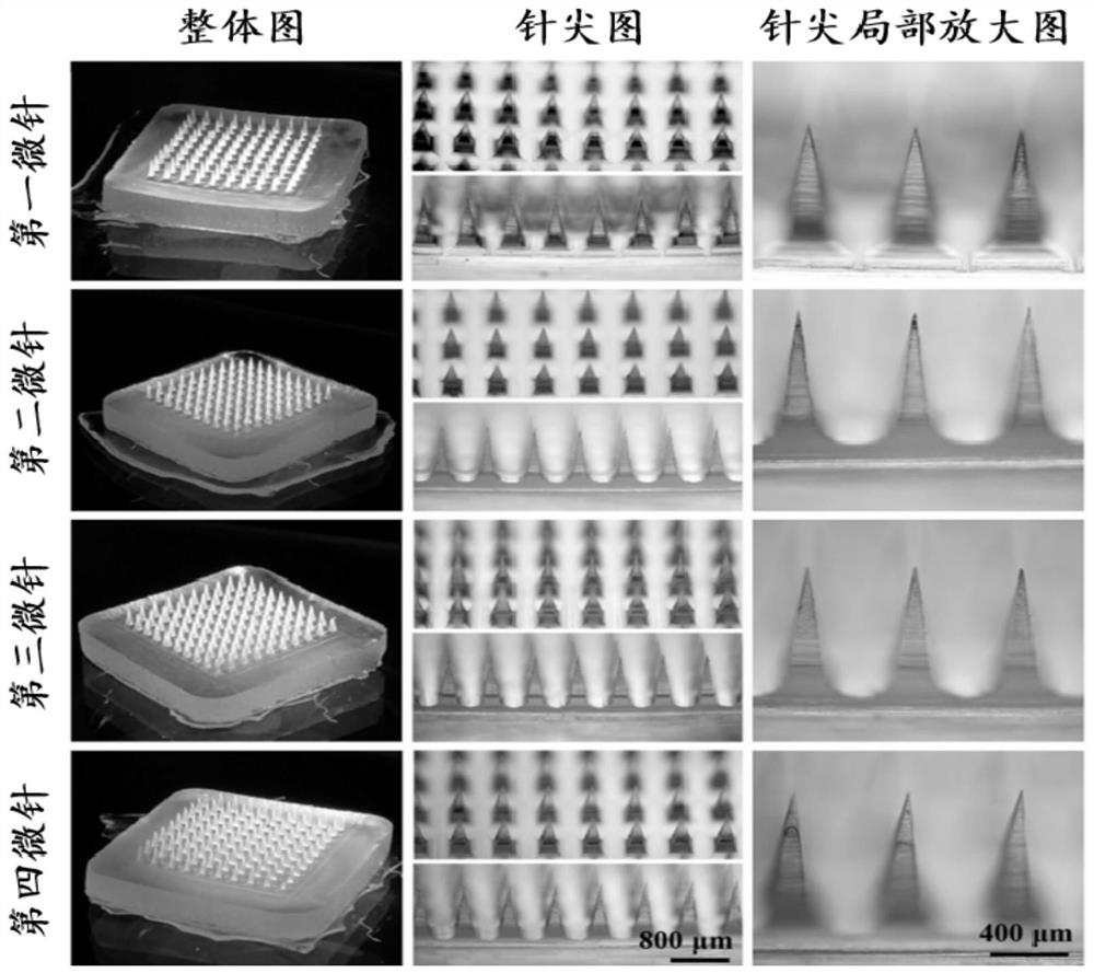 Microneedle for treating vitiligo as well as preparation method and application thereof